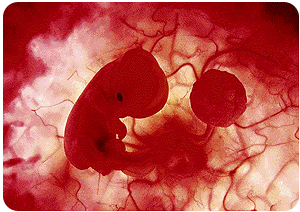 Η σχιζοφρενική αντιμετώπιση της ζωής του εμβρύου